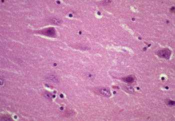 red neurons